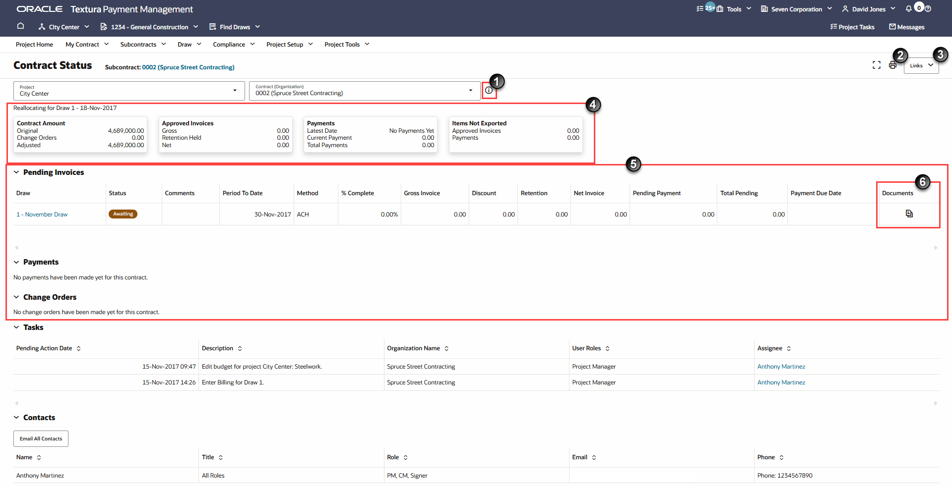 Contract Status Page with Number Markers
