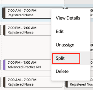Right-Click Split Shift Action
